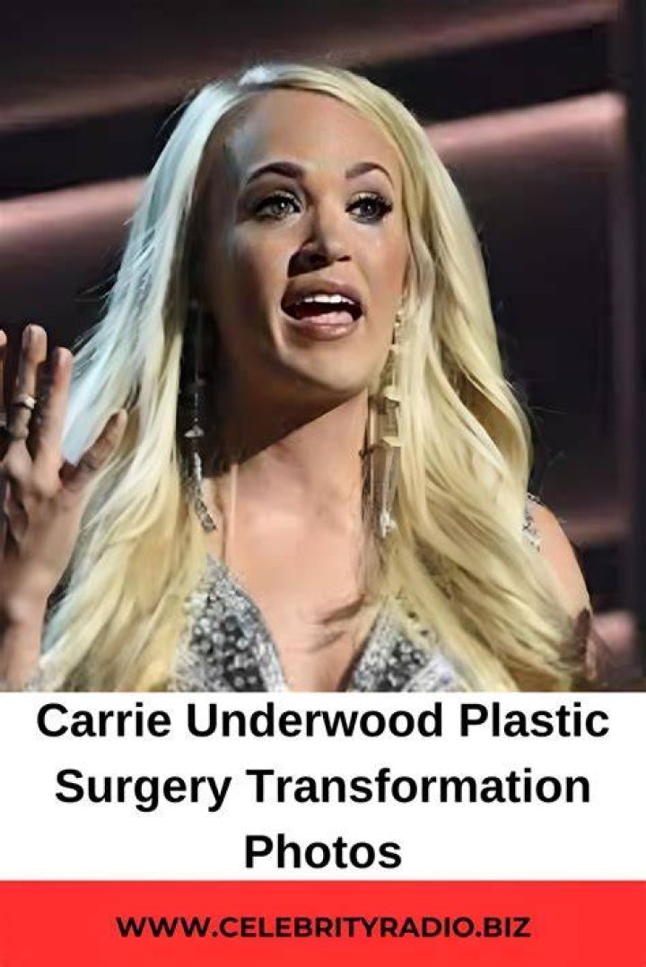 Carrie Underwood&rsquo;s Plastic Surgery Quotes Over the Years