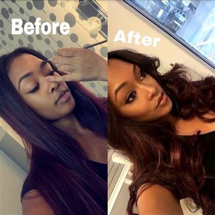 Miracle Watts before and after photo