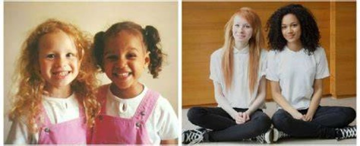 Twins With Different Fathers In Brazil